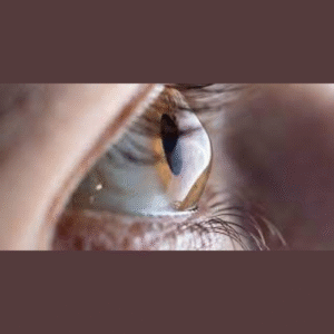 eye care FAQs Ahmedabad